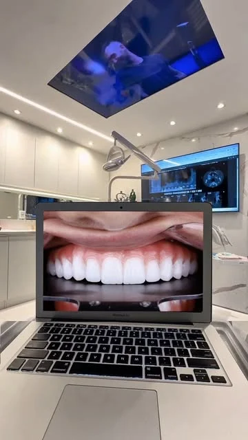 Planejamento digital do sorriso no computador