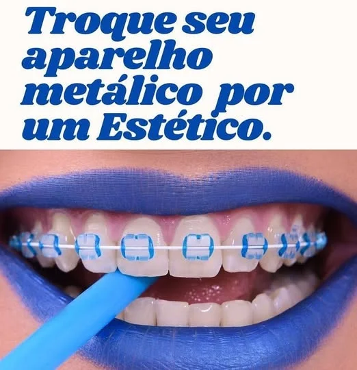Aparelho estético sendo colocado