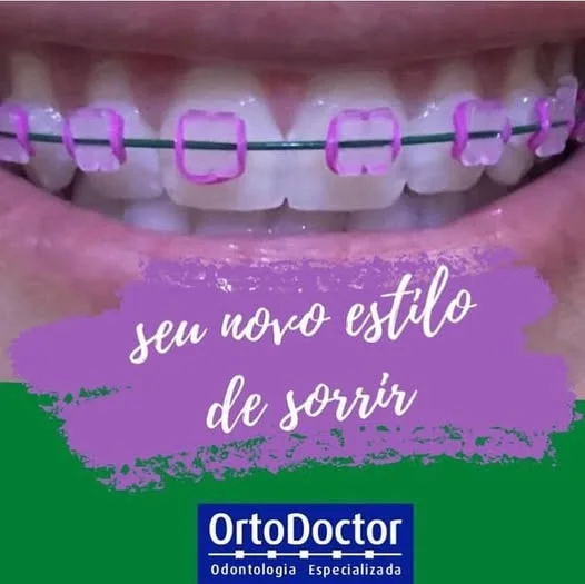 Aparelho com borrachinhas lilás