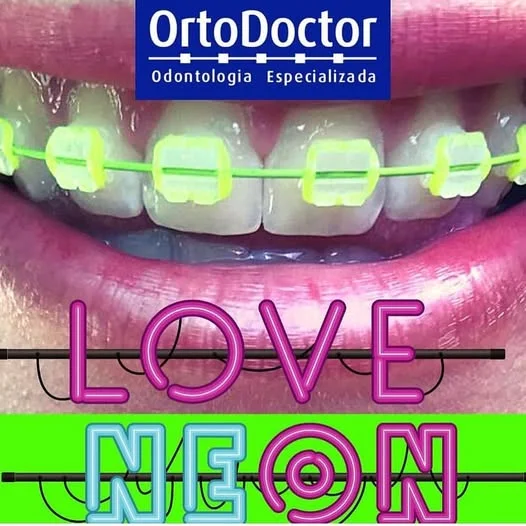 Aparelho com borrachinhas neon